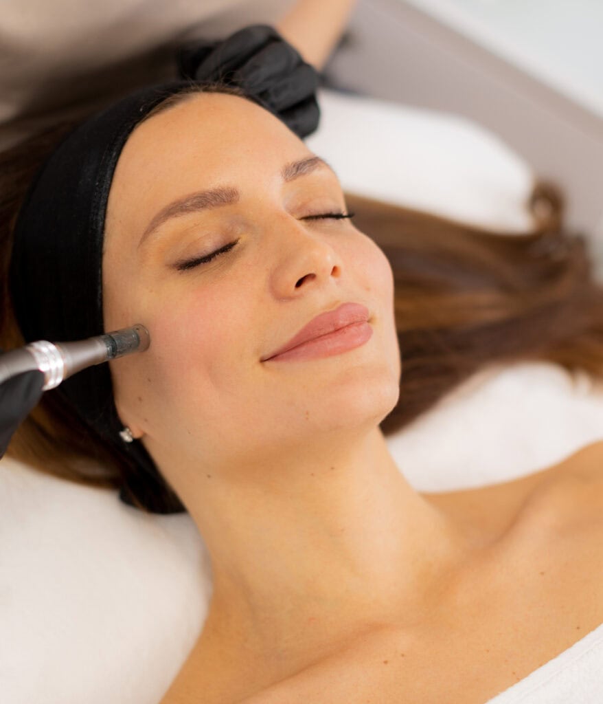 microneedling ROG Medspa Houston