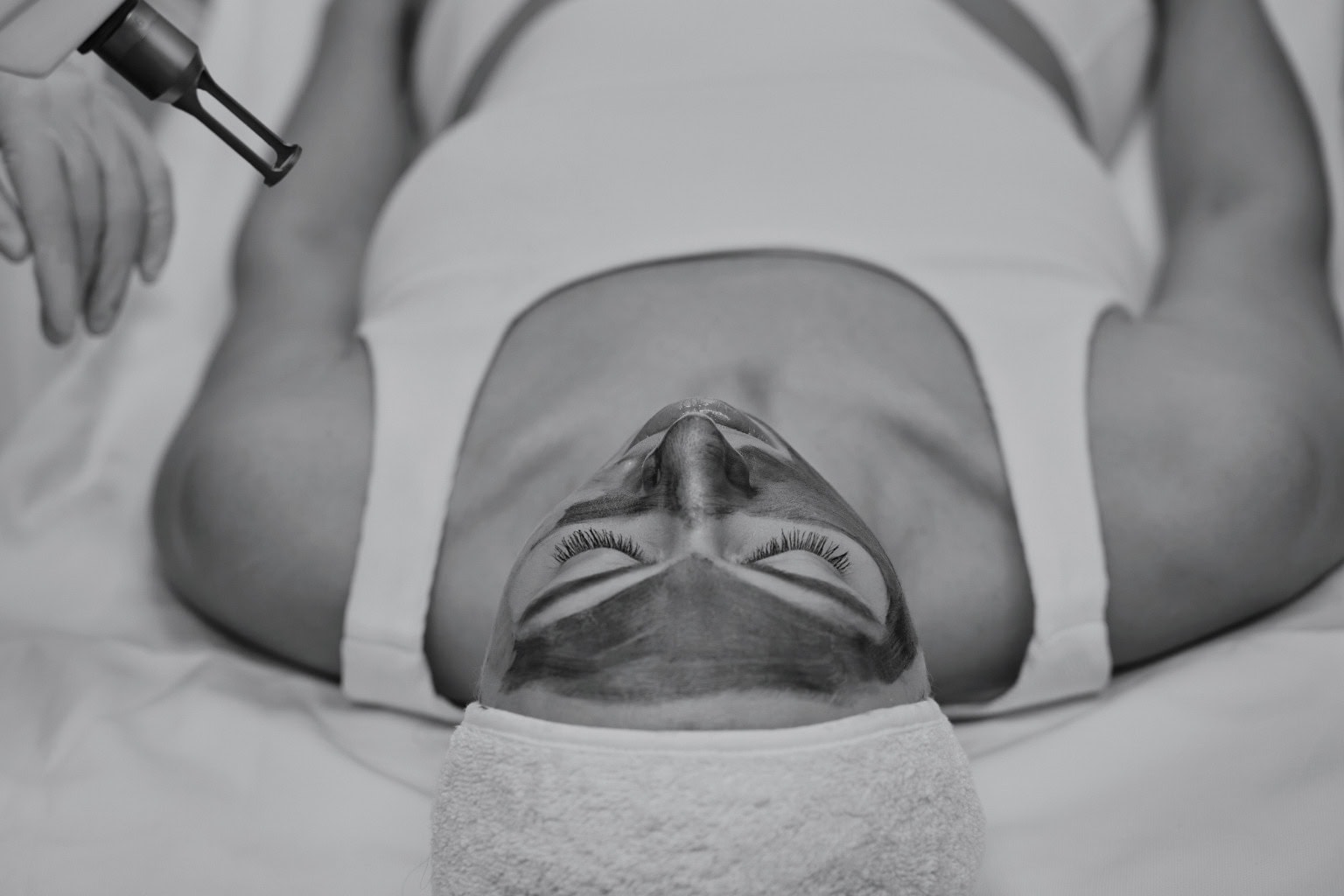 Hollywood laser peel